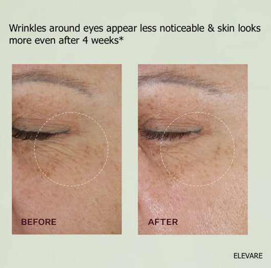 KOVA - A Retinal Shot Tightening Booster