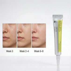 Stay Consistent, Watch Skin Transform