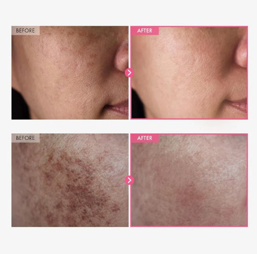 KOVA TXA Arbutin Brightening Cream